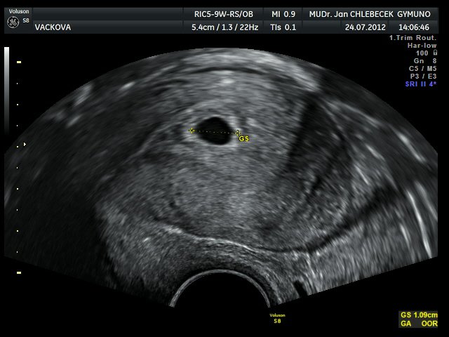 Image IMG_20120916_5_1.jpg