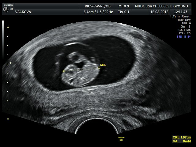 Image IMG_20120916_5_2.jpg