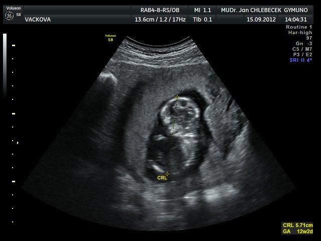 Image IMG_20120916_5_3.jpg