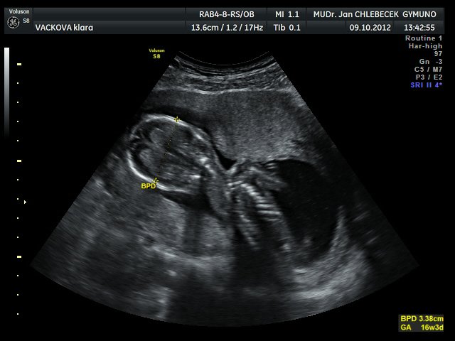 Image IMG_20121009_1_2.jpg