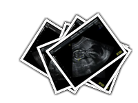 001-ultrazvuk album picture